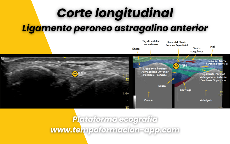 6. Anatomia ecografica Tempo Formacion.png